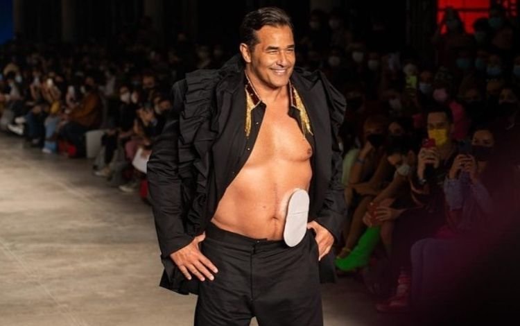 Luciano Szafir desfilou no SPFW mostrando a bolsa de colostomia que está usando