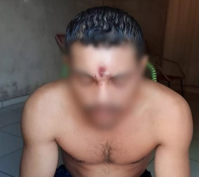Homem levou tiro na testa e sobreviveu em Araguaína - Foto: Reprodução/Redes sociais
