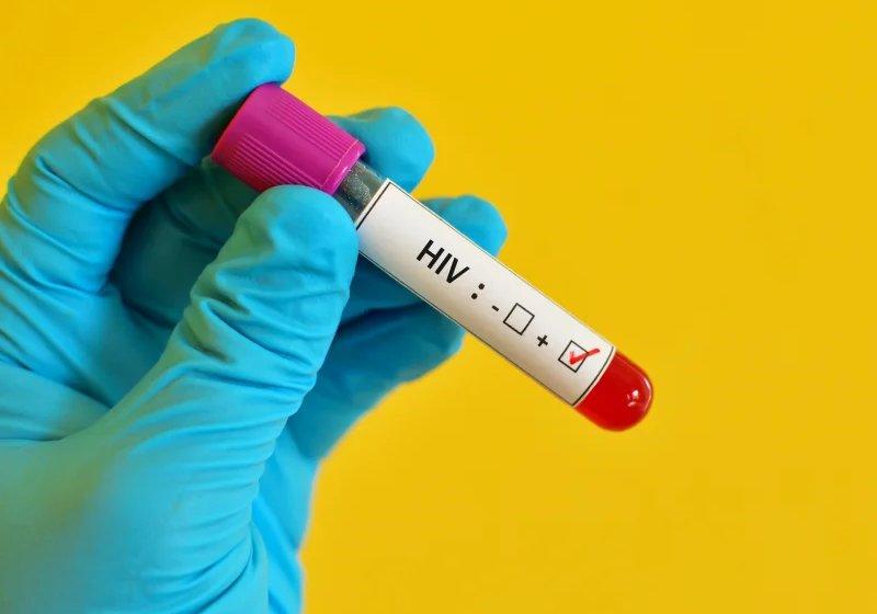 O 4º caso de cura do HIV no mundo foi anunciado conferência Aids 2022, em Montreal, no Canadá - Foto: jarun011/Getty Images