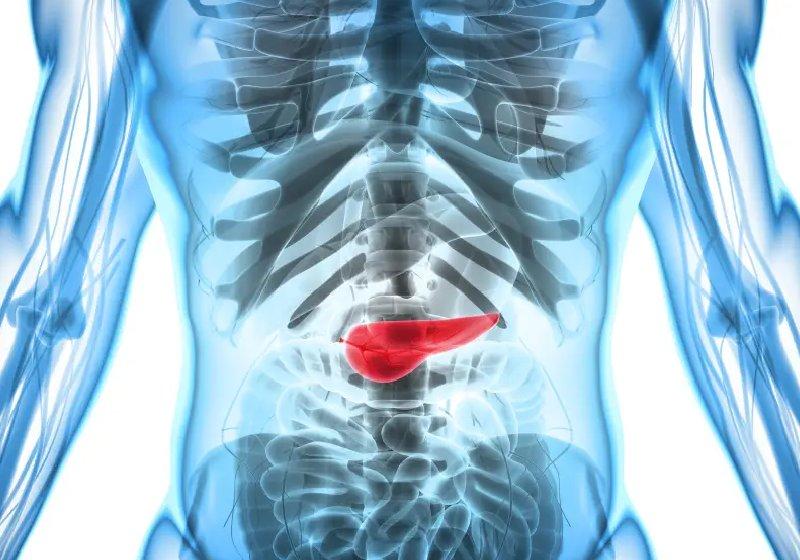 Um inibir de enzima conseguiu frear o câncer de pâncreas, um dos mais letais - Foto: IStock / Getty Images